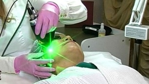 klady a zápory laserového omlazení pokožky obličeje